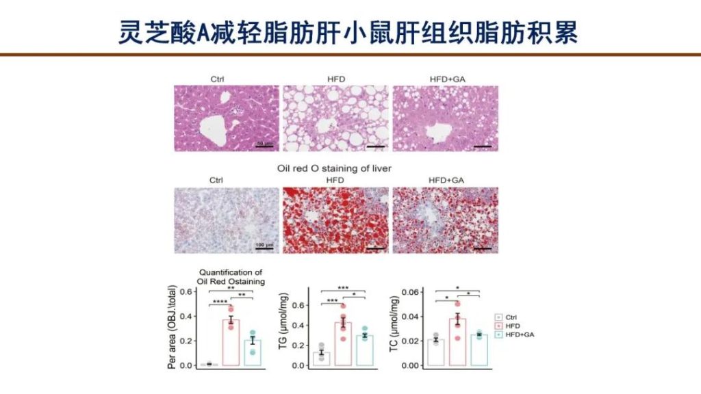 Ganoderic Acid A intervention group was close to normal
