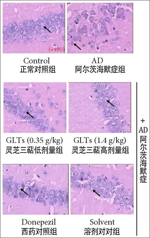 Reishi triterpenes have a certain protective effect on the hippocampus